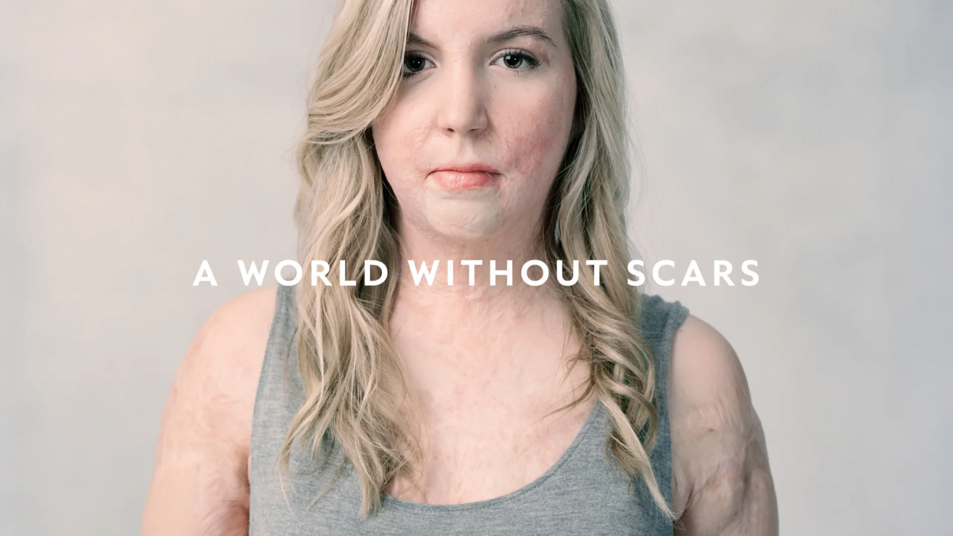 Scar Free images10
