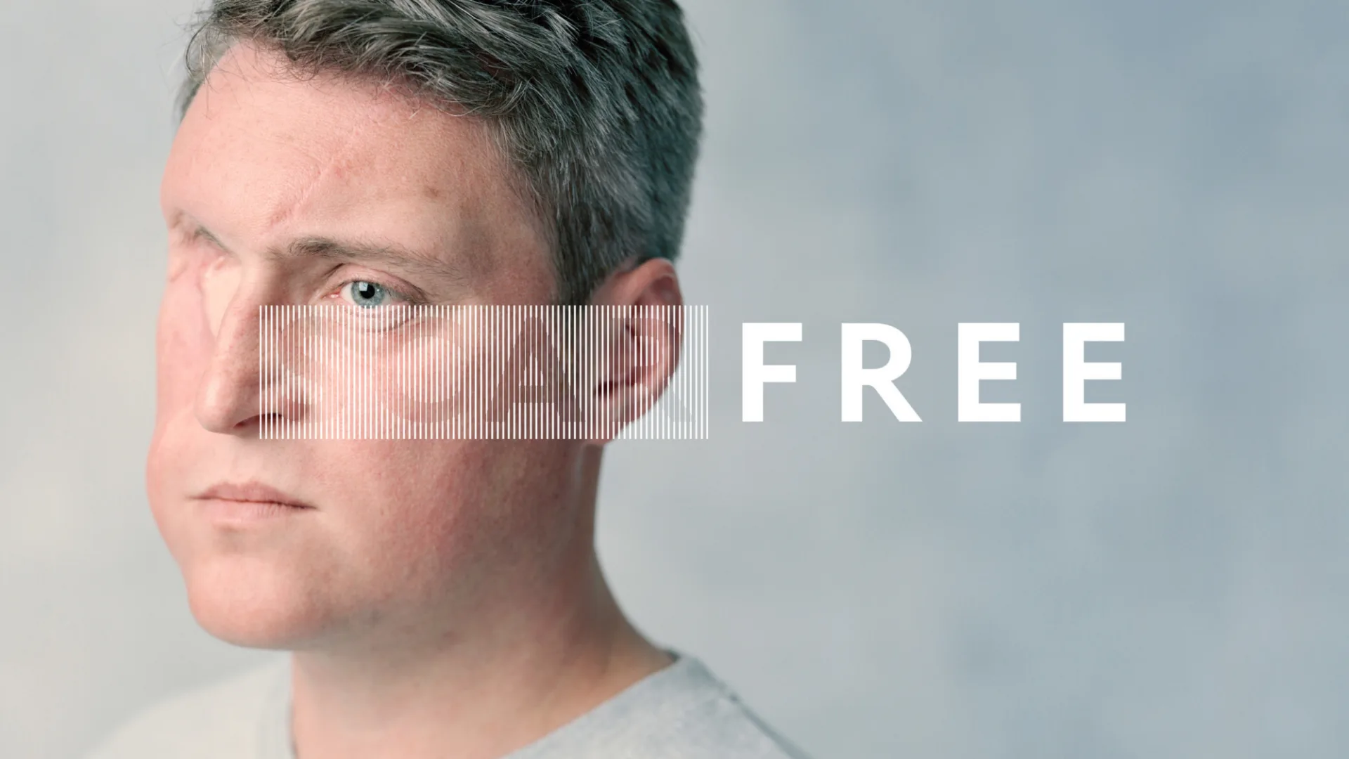 Scar Free images8